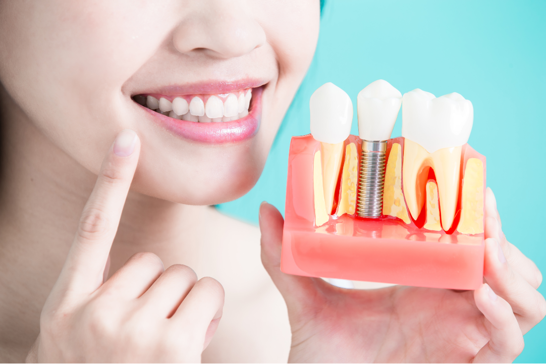 Wisdom Tooth Extraction: Procedure, Recovery, and Aftercare