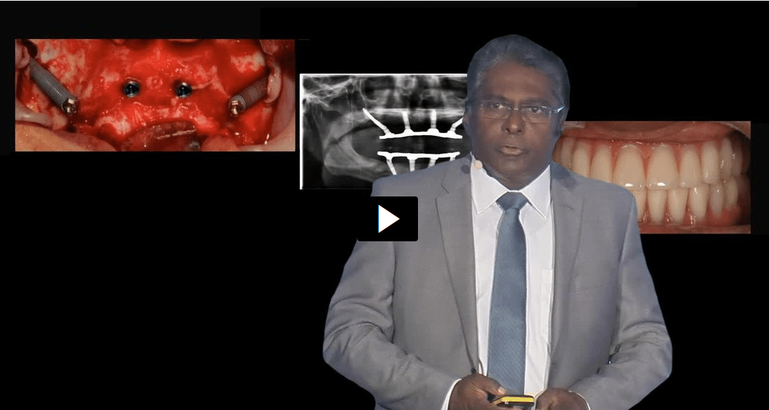 Dr.Gunaseelan Rajan: To graft or not to graft?