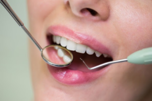 WHY A REGULAR DENTAL CHECKUP IS IMPORTANT?