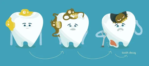 COMMON SYMPTOMS OF TOOTH DECAY