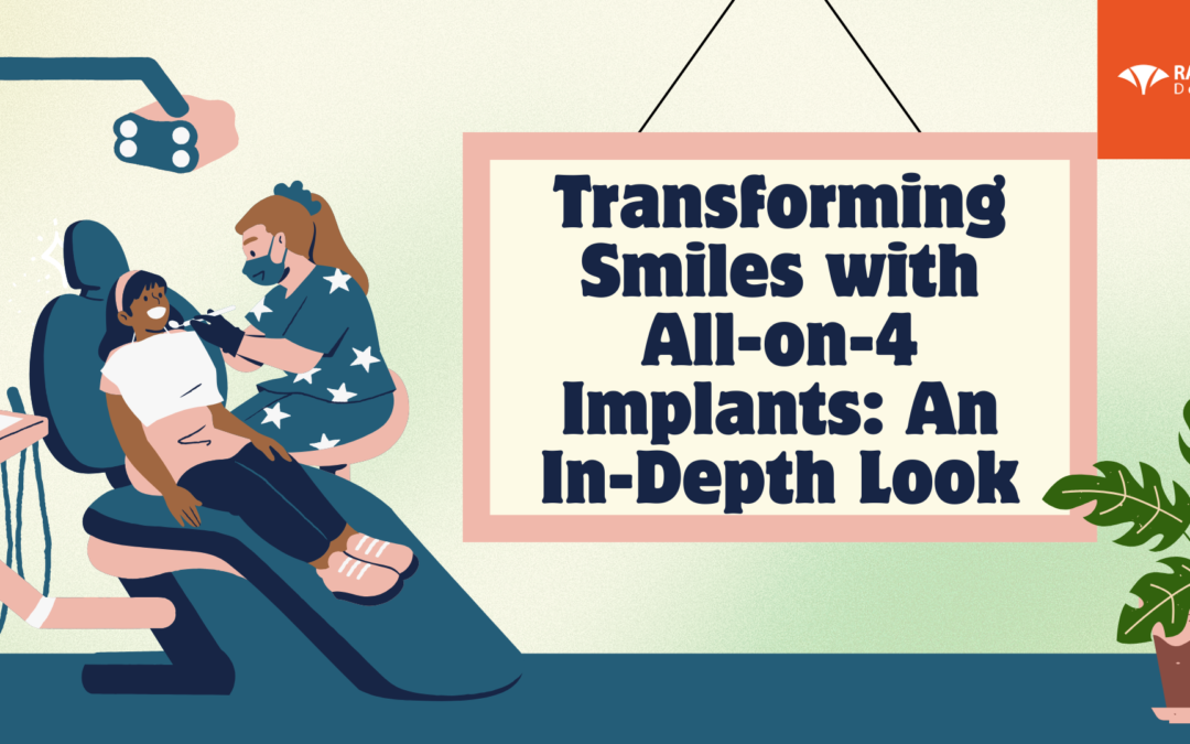Transforming Smiles with All-on-4 Implants: An In-Depth Look